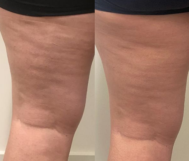 CHOOSE YOU CELLULITE REDUCING COFFEE SCRUB